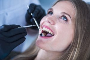 Todo lo que debes saber sobre el tratamiento de curetaje dental