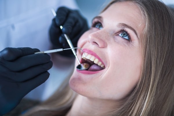 Todo lo que debes saber sobre el tratamiento de curetaje dental