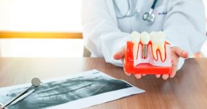 Cómo se coloca un implante dental